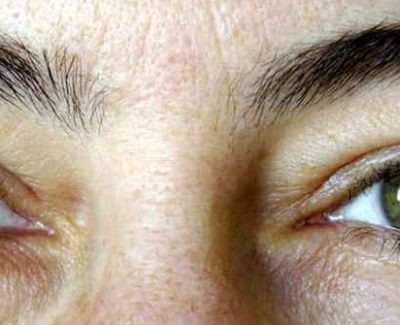 ¿Son los ojos claros más sensibles a la luz?