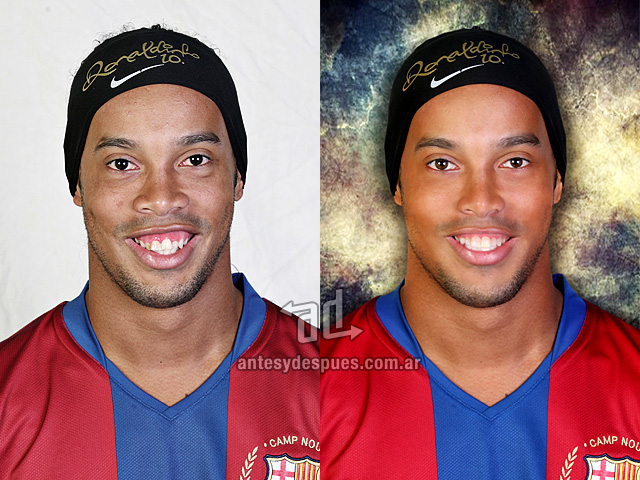 Ronaldinho antes y despues