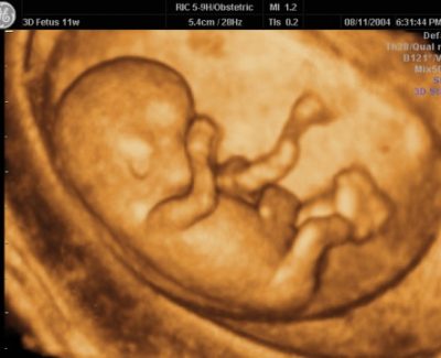 Texas obliga a oir el latido del feto antes de abortar